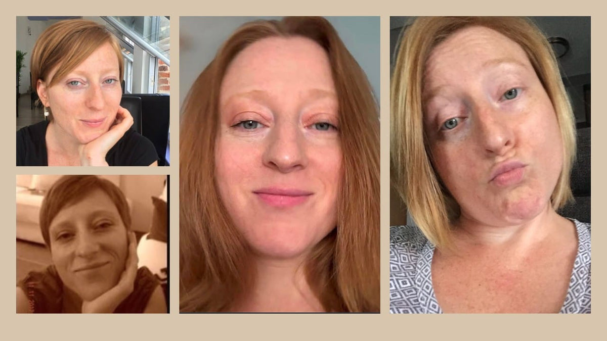 Collage de portraits montrant l'évolution et l'état de la peau d'une femme.